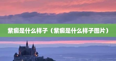 紫癜是什么样子（紫癜是什么样子图片）