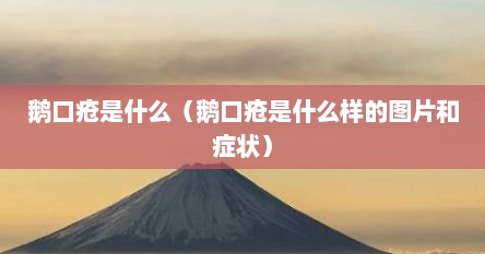 鹅口疮是什么（鹅口疮是什么样的图片和症状）