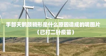 手部天鹅颈畸形是什么原因造成的呢图片（已打二针疫苗）